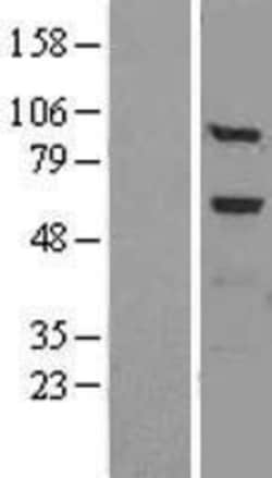 Novus Biologicals™ Tissue alpha-L-Fucosidase/FUCA1 Overexpression Lysate