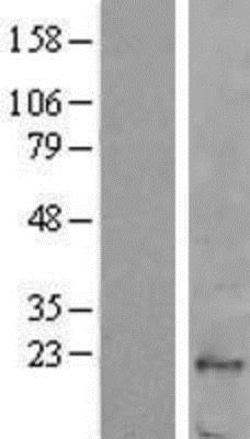 Novus Biologicals&trade;&nbsp;Fucose Mutarotase Overexpression Lysate