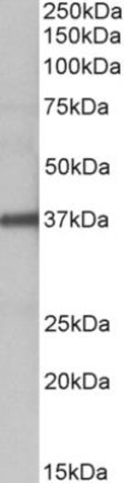 Fucosyltransferase 2/FUT2 Antibody, Novus Biologicals 0.1mg; Unlabeled:Antibodies,