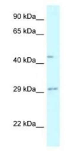Fucosyltransferase 8/FUT8 Antibody, Novus Biologicals:Antibodies:Primary