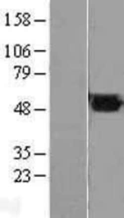 Novus Biologicals™ Fumarase Overexpression Lysate