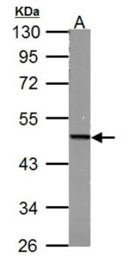 Fumarase Antibody, Novus Biologicals 100 &mu;L | Buy Online | Novus Biologicals | Fisher Scientific