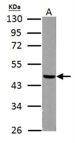 Fumarase Antibody, Novus Biologicals 100 &mu;L | Buy Online | Novus Biologicals | Fisher Scientific