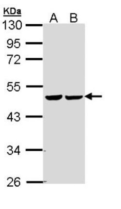 Fumarase Antibody, Novus Biologicals 100 &mu;L | Buy Online | Novus Biologicals | Fisher Scientific