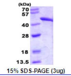 Novus Biologicals&trade;&nbsp;Recombinant Human Fumarase Protein
