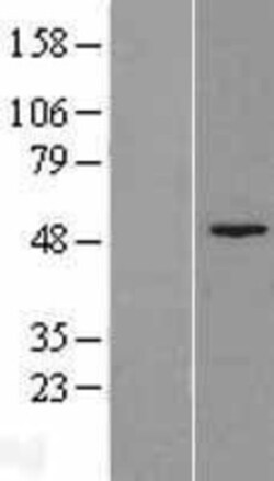 Novus Biologicals&trade;&nbsp;Fumarylacetoacetate hydrolase Overexpression Lysate