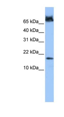 FUNDC1 Antibody, Novus Biologicals 0.05mg; Unlabeled:Antibodies, Polyclonal