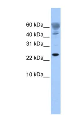 FUNDC1 Antibody, Novus Biologicals 0.05mg; Unlabeled:Antibodies, Polyclonal