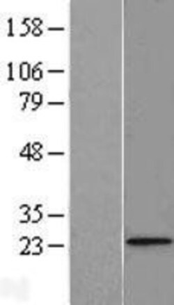 Novus Biologicals&trade;&nbsp;FUNDC2 Overexpression Lysate