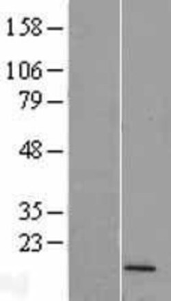 Novus Biologicals&trade;&nbsp;FUNDC2P2 Overexpression Lysate