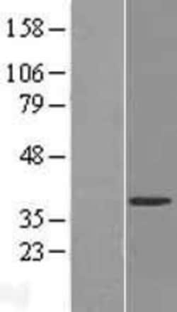 Novus Biologicals&trade;&nbsp;FUR1 Overexpression Lysate