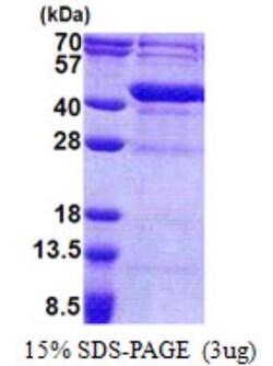 Novus Biologicals&trade;&nbsp;Recombinant Human FUR1 His Protein