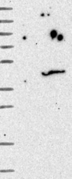 FUR1 Antibody, Novus Biologicals 0.1mL; Unlabeled:Antibodies, Polyclonal