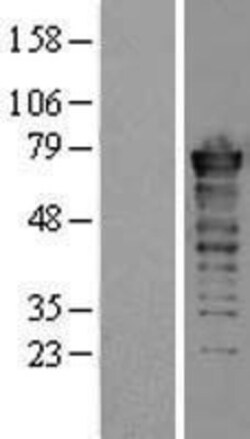 Novus Biologicals™ FUS Overexpression Lysate