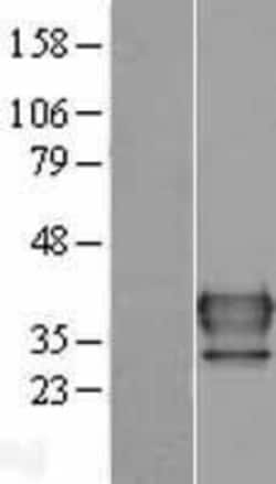 Novus Biologicals&trade;&nbsp;FUS2 Overexpression Lysate