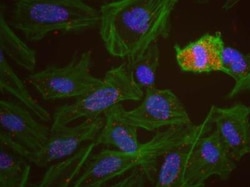 FUS Antibody, Novus Biologicals 0.1mL; Unlabeled:Antibodies