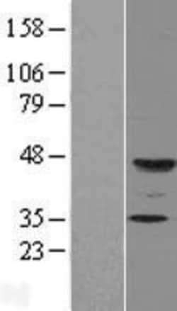 Novus Biologicals&trade;&nbsp;FUT9 Overexpression Lysate