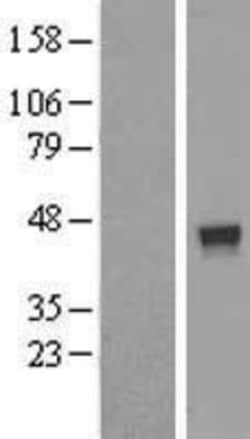 Novus Biologicals&trade;&nbsp;FUZ Overexpression Lysate