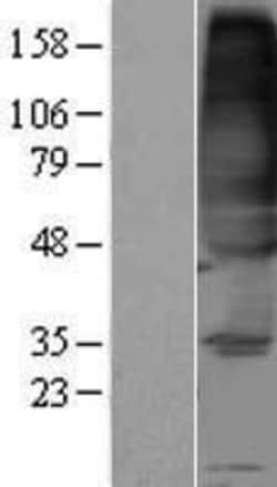 Novus Biologicals&trade;&nbsp;FVT1 Overexpression Lysate