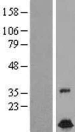 Novus Biologicals™ FXC1 Overexpression Lysate
