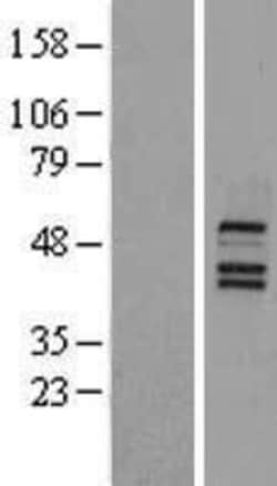 Novus Biologicals&trade;&nbsp;FXR/NR1H4 Overexpression Lysate