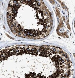 FXR1 Antibody, Novus Biologicals 0.1mL; Unlabeled:Antibodies, Polyclonal