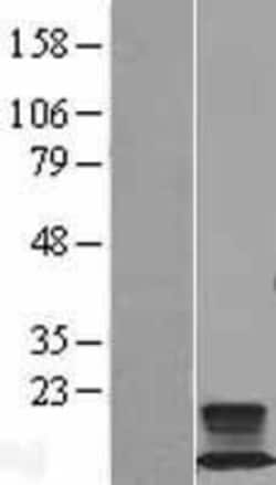 Novus Biologicals™ FXYD2 Overexpression Lysate