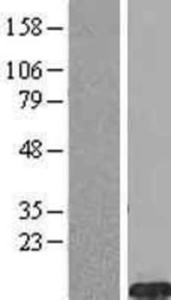 Novus Biologicals™ FXYD2 Overexpression Lysate