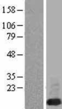 Novus Biologicals FXYD6 Overexpression Lysate 0.1 mg | Buy Online | Novus Biologicals&trade; | Fisher Scientific