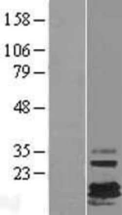 Novus Biologicals™ FXYD7 Overexpression Lysate