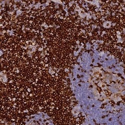 FYB/ADAP/SLAP130 Antibody, Novus Biologicals 25 &mu;L | Buy Online | Novus Biologicals | Fisher Scientific