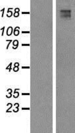 Novus Biologicals™ FYCO1 Overexpression Lysate