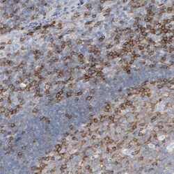 Fyn Antibody, Novus Biologicals:Antibodies:Primary Antibodies
