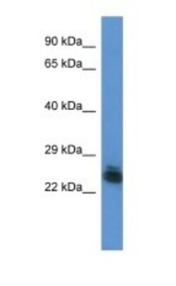 FYTTD1 Antibody, Novus Biologicals:Antibodies:Primary Antibodies