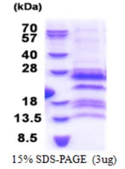 Novus Biologicals&trade;&nbsp;Recombinant Human G antigen 12F His Protein