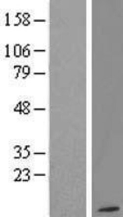 Novus Biologicals&trade;&nbsp;G gamma12 Overexpression Lysate