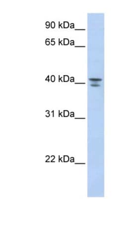 G protein alpha 12 Antibody, Novus Biologicals:Antibodies:Primary Antibodies