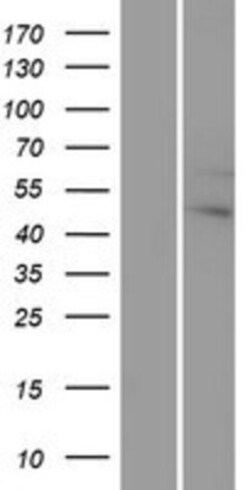 Novus Biologicals&trade;&nbsp;G protein alpha 12 Overexpression Lysate