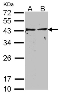 G protein alpha inhibitor 1 Antibody, Novus Biologicals 0.1mg; Unlabeled:Antibodies,