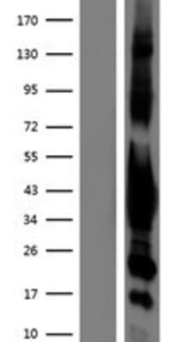 Novus Biologicals&trade;&nbsp;G protein alpha inhibitor 1 Overexpression Lysate