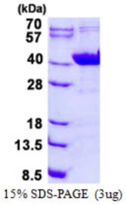 Novus Biologicals&trade;&nbsp;Recombinant Human G protein alpha Inhibitor 2 His Protein