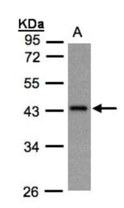 G Protein alpha z Antibody, Novus Biologicals 0.1mg; Unlabeled:Antibodies,