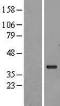 Novus Biologicals&trade;&nbsp;GBL Overexpression Lysate