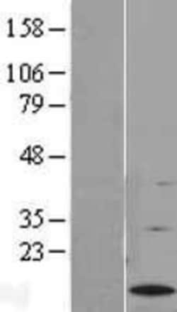 Novus Biologicals&trade;&nbsp;G0S2 Overexpression Lysate