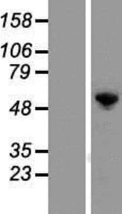 Novus Biologicals&trade;&nbsp;G3BP1 Overexpression Lysate