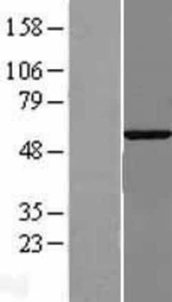 Novus Biologicals&trade;&nbsp;G3BP2 Overexpression Lysate