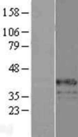 Novus Biologicals&trade;&nbsp;G6PC Overexpression Lysate