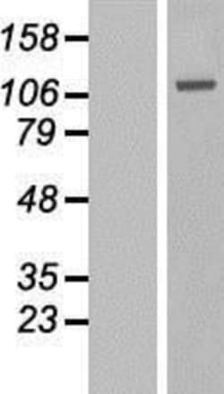 Novus Biologicals&trade;&nbsp;LYAG/GAA Overexpression Lysate