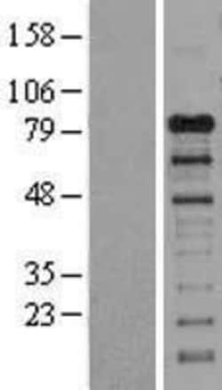 Novus Biologicals™ GAB1 Overexpression Lysate