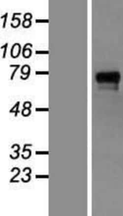 Novus Biologicals&trade;&nbsp;GAB1 Overexpression Lysate
